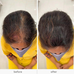 Forehead Cover Clip-In Bangs Wig