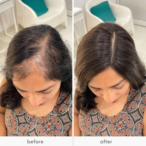 Silky Crown Volume Topper